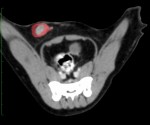 赤丸:乳腺腫瘍部分