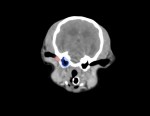 青色:中耳は液体貯留なし 赤線:外耳道内の液体貯留