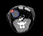 青丸:卵巣腫瘤 赤丸:子宮頸部 子宮との連続が認められることより腫瘤は卵巣と確認された