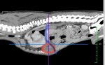 CT① 青線:横隔膜があるべきライン 赤丸:胸腔内へ逸脱している小腸、脂肪