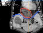 CT② 青線:横隔膜があるべきライン 赤丸:胸腔内へ逸脱している小腸、脂肪