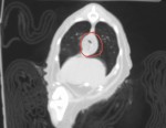 無麻酔CT検査:赤丸が食道周囲の腫瘤病変