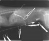 写真2:症例1の門脈造影所見。後大静脈への短絡が明らか。術前のNH3濃度は146μg/dlが術後6日目には56μg/dlに低下。